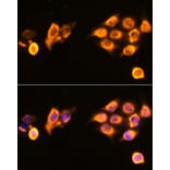Immunofluorescence - Anti-ASPM Antibody (A306282) - Antibodies.com