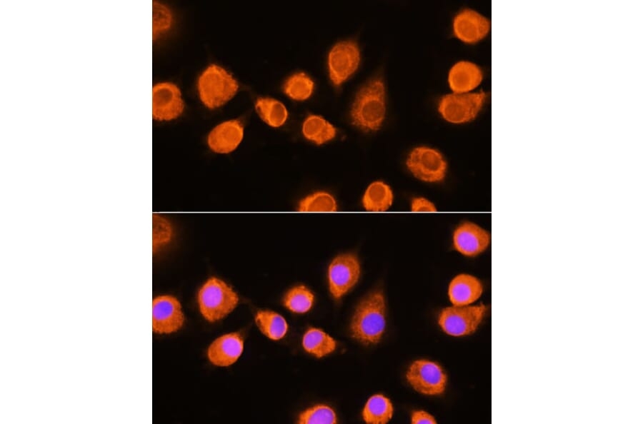 Immunofluorescence - Anti-ASPM Antibody (A306282) - Antibodies.com