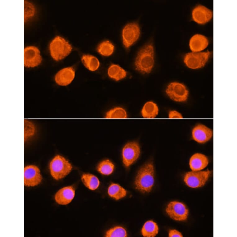 Immunofluorescence - Anti-ASPM Antibody (A306282) - Antibodies.com