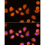 Immunofluorescence - Anti-ASPM Antibody (A306282) - Antibodies.com