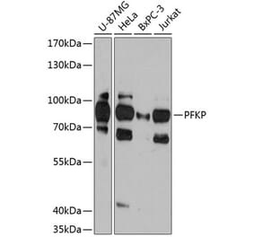 Western Blot - Anti-PFKP Antibody (A306283) - Antibodies.com