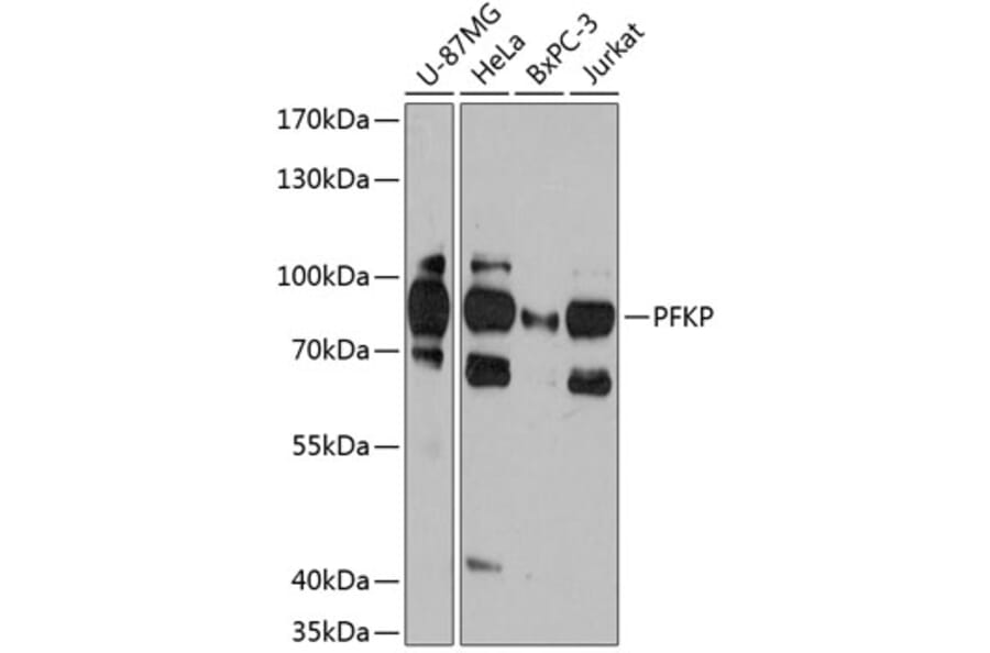 Western Blot - Anti-PFKP Antibody (A306283) - Antibodies.com
