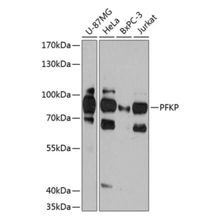 Western Blot - Anti-PFKP Antibody (A306283) - Antibodies.com