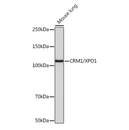 Western Blot - Anti-CRM1 Antibody [ARC0104] (A306284) - Antibodies.com