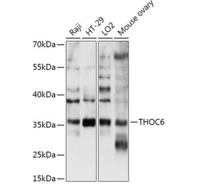 Western Blot - Anti-THOC6 Antibody (A306285) - Antibodies.com