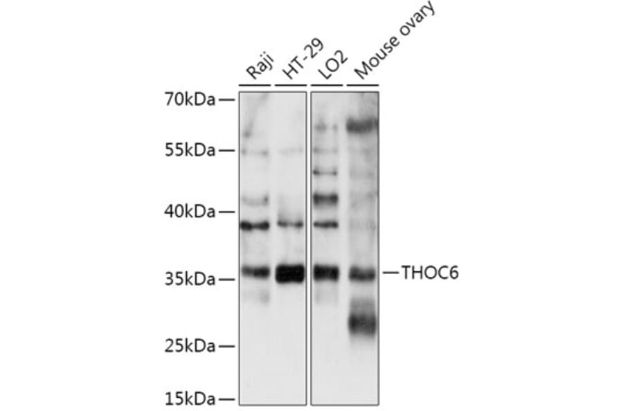 Western Blot - Anti-THOC6 Antibody (A306285) - Antibodies.com