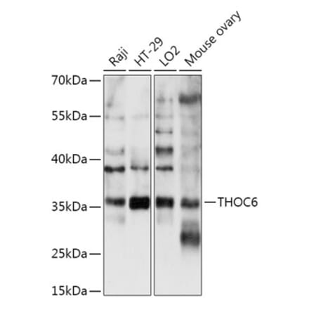 Western Blot - Anti-THOC6 Antibody (A306285) - Antibodies.com