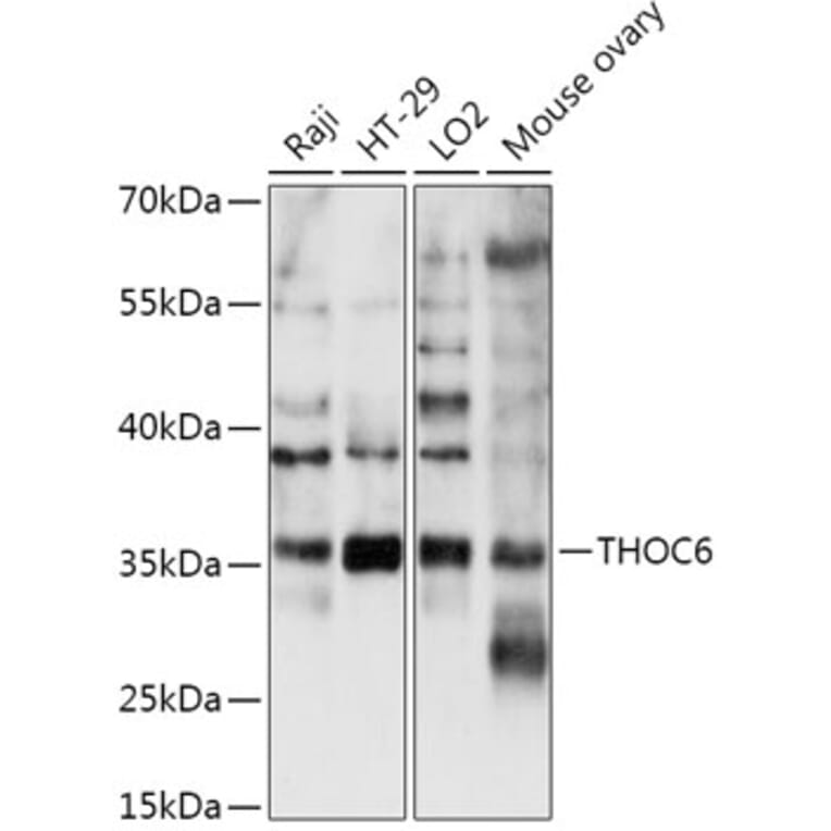 Western Blot - Anti-THOC6 Antibody (A306285) - Antibodies.com