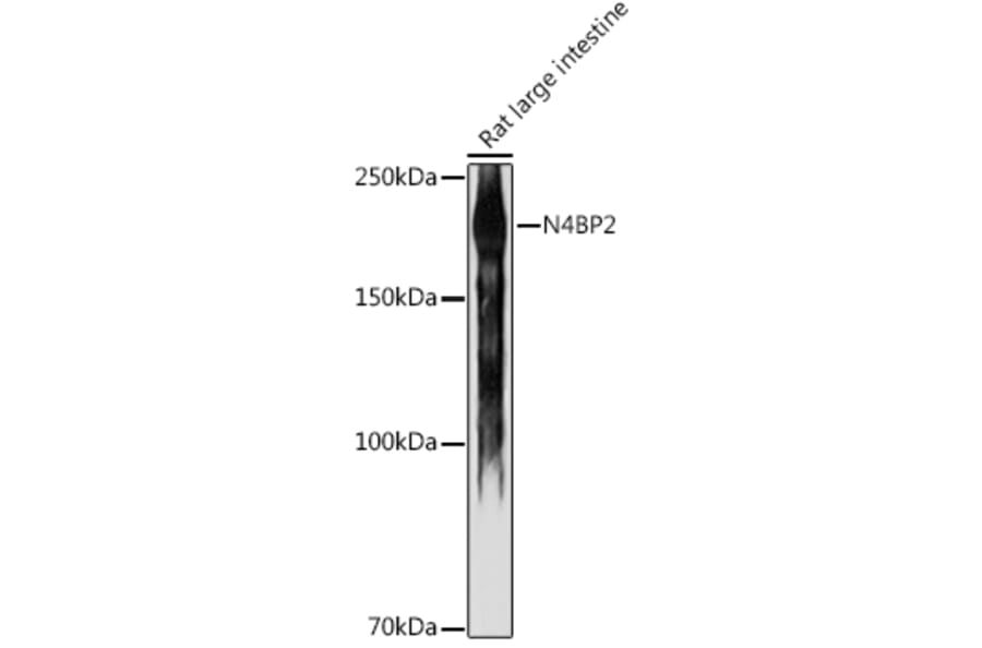 Western Blot - Anti-N4BP2 Antibody (A306286) - Antibodies.com