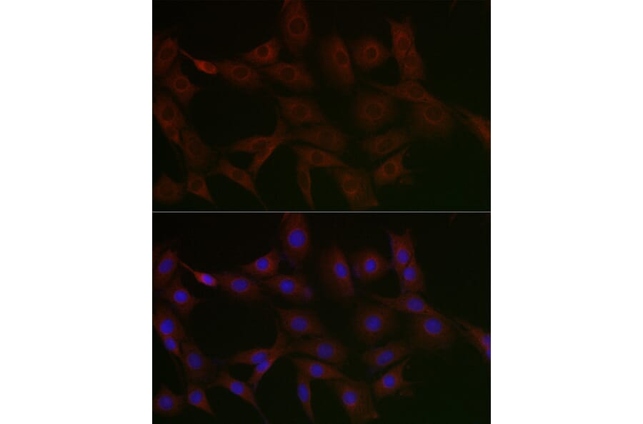 Immunofluorescence - Anti-N4BP2 Antibody (A306286) - Antibodies.com