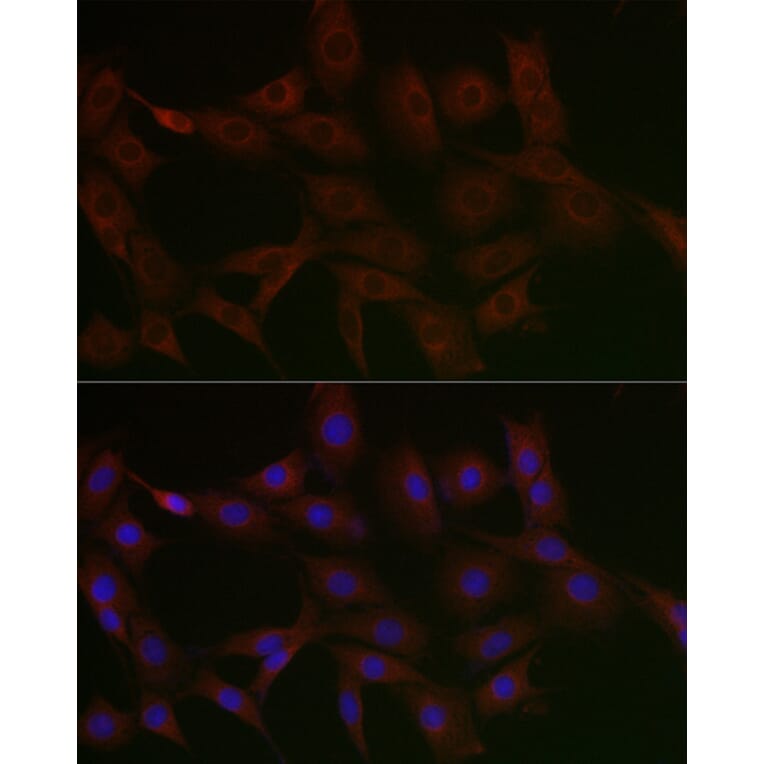 Immunofluorescence - Anti-N4BP2 Antibody (A306286) - Antibodies.com
