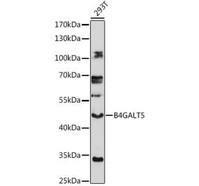 Western Blot - Anti-B4GALT5 Antibody (A306287) - Antibodies.com