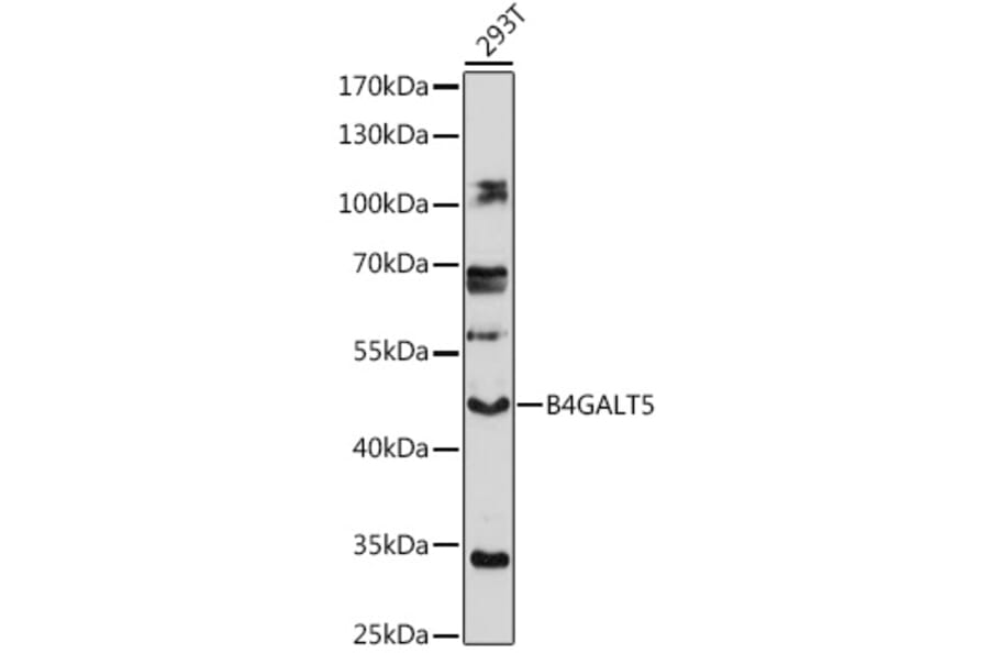 Western Blot - Anti-B4GALT5 Antibody (A306287) - Antibodies.com