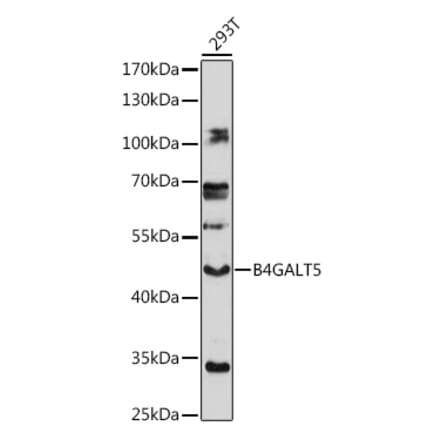 Western Blot - Anti-B4GALT5 Antibody (A306287) - Antibodies.com