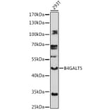 Western Blot - Anti-B4GALT5 Antibody (A306287) - Antibodies.com