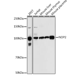 Western Blot - Anti-NOP2 Antibody (A306288) - Antibodies.com
