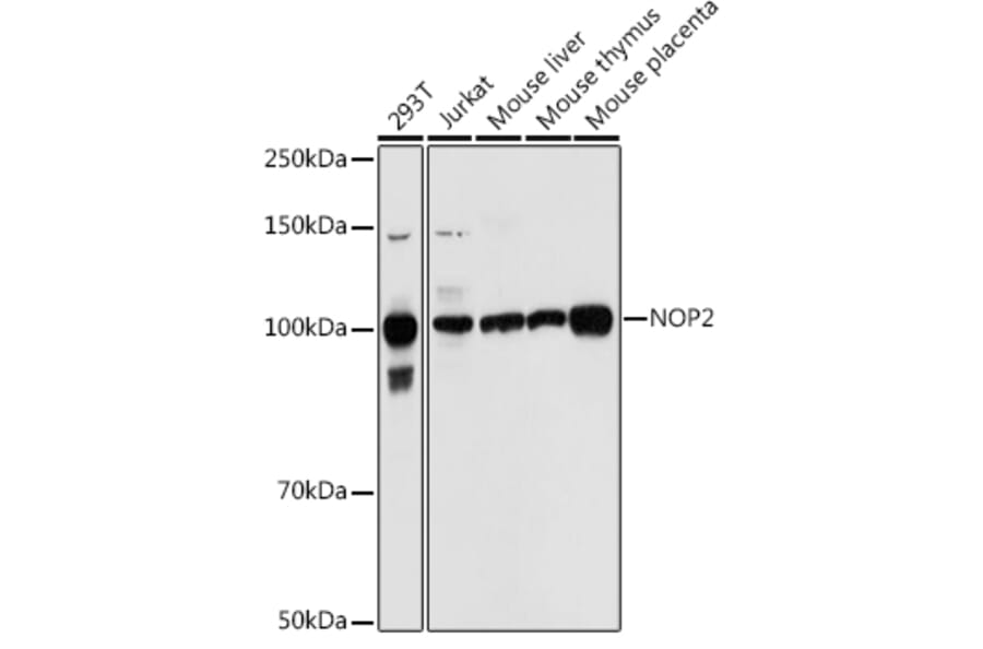 Western Blot - Anti-NOP2 Antibody (A306288) - Antibodies.com