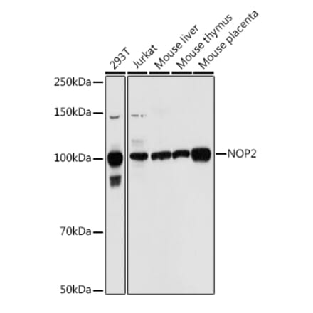 Western Blot - Anti-NOP2 Antibody (A306288) - Antibodies.com