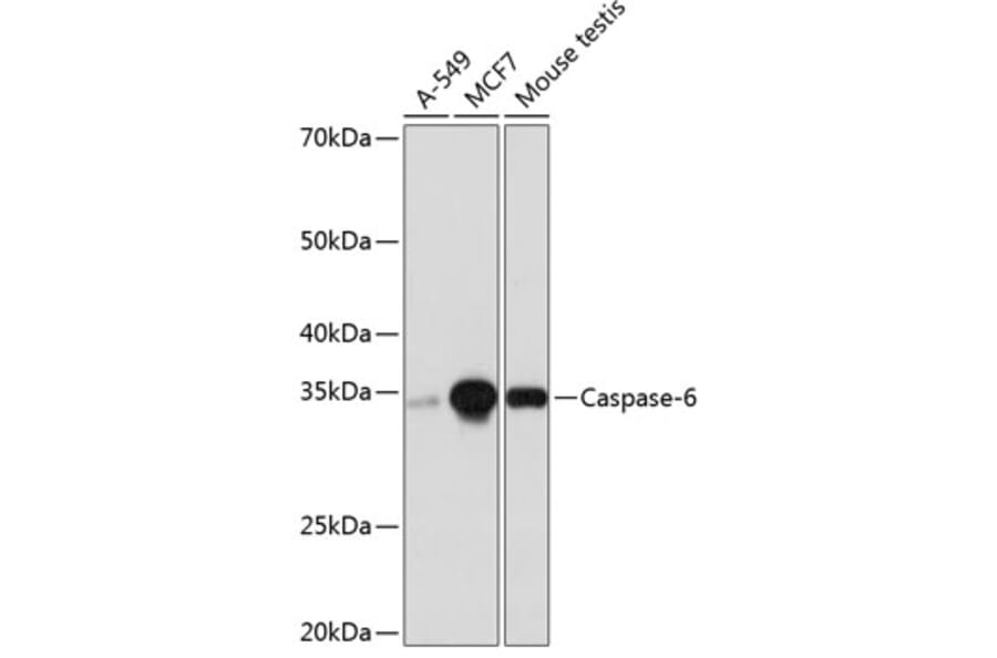 Western Blot - Anti-Caspase-6/CASP-6 Antibody [ARC0038] (A306289) - Antibodies.com