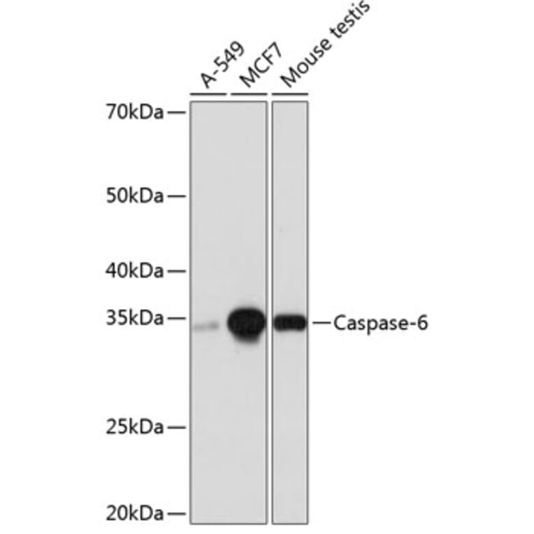 Western Blot - Anti-Caspase-6/CASP-6 Antibody [ARC0038] (A306289) - Antibodies.com
