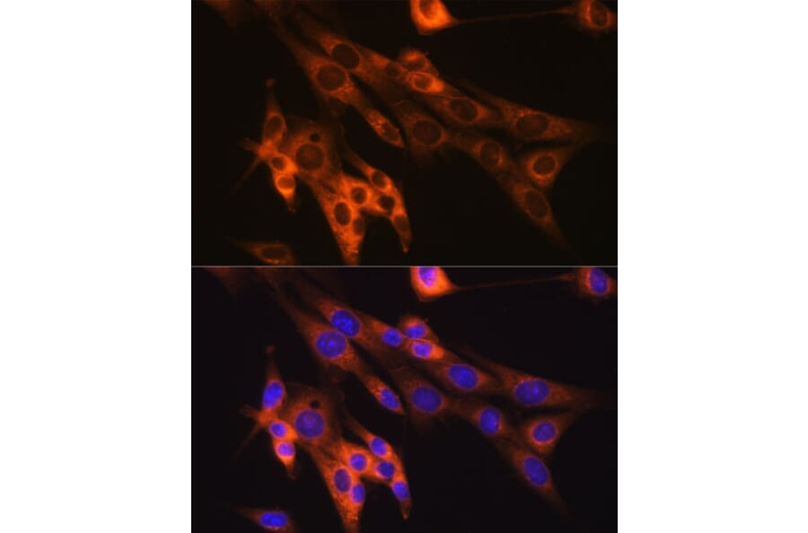 Immunofluorescence - Anti-Caspase-6/CASP-6 Antibody [ARC0038] (A306289) - Antibodies.com