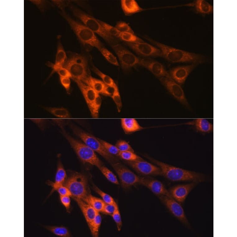 Immunofluorescence - Anti-Caspase-6/CASP-6 Antibody [ARC0038] (A306289) - Antibodies.com