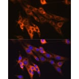 Immunofluorescence - Anti-Caspase-6/CASP-6 Antibody [ARC0038] (A306289) - Antibodies.com