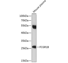 Western Blot - Anti-CD64 Antibody (A306290) - Antibodies.com