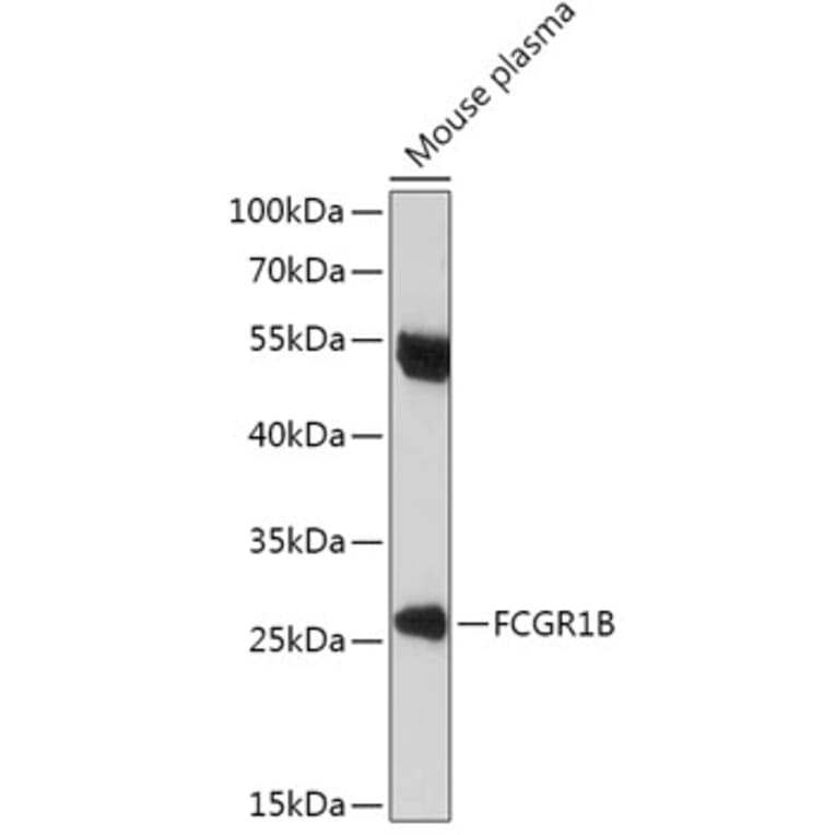 Western Blot - Anti-CD64 Antibody (A306290) - Antibodies.com