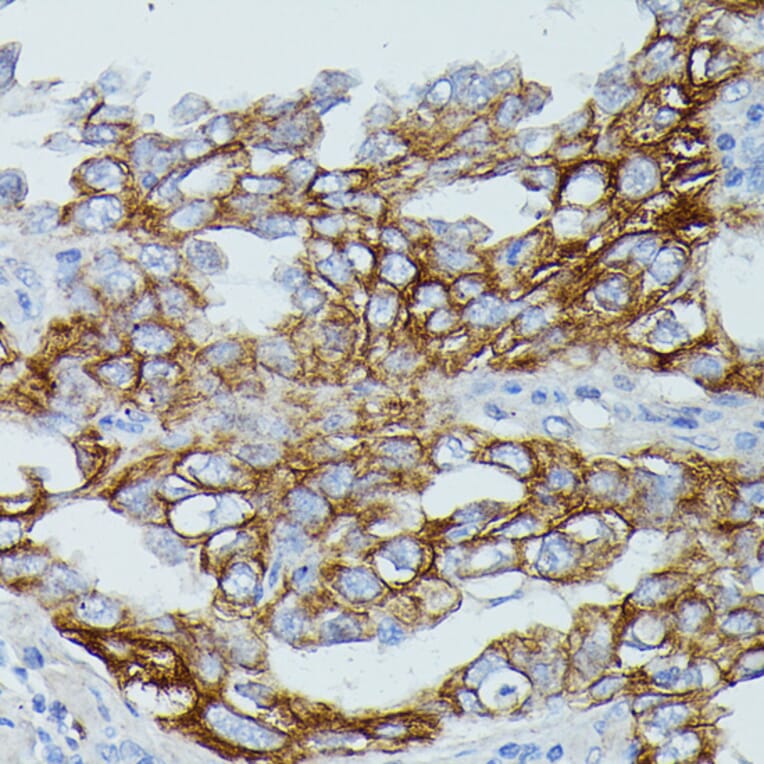 Immunohistochemistry - Anti-CD64 Antibody (A306290) - Antibodies.com