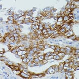 Immunohistochemistry - Anti-CD64 Antibody (A306290) - Antibodies.com