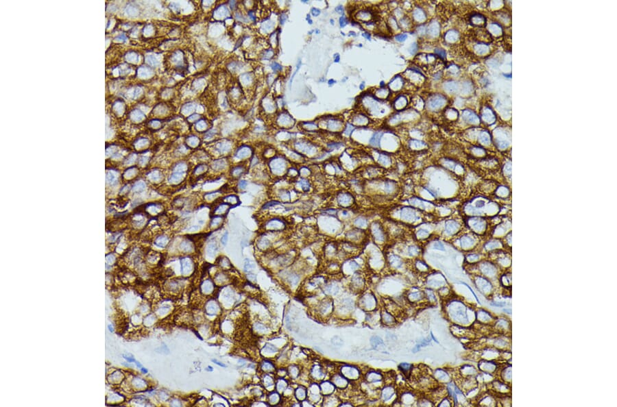 Immunohistochemistry - Anti-CD64 Antibody (A306290) - Antibodies.com