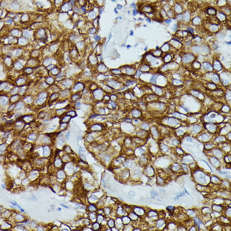 Immunohistochemistry - Anti-CD64 Antibody (A306290) - Antibodies.com