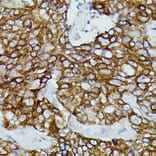 Immunohistochemistry - Anti-CD64 Antibody (A306290) - Antibodies.com