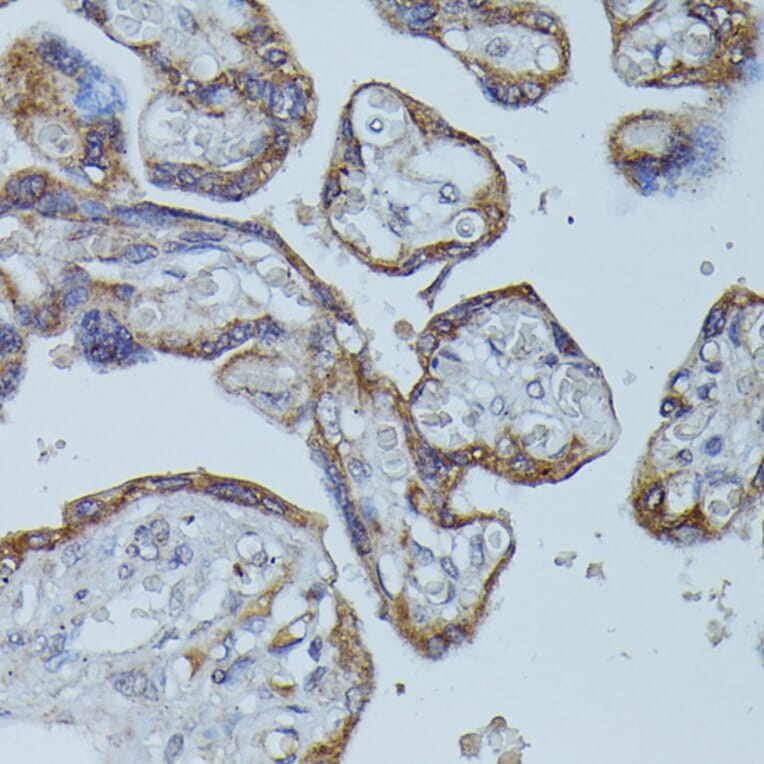 Immunohistochemistry - Anti-CD64 Antibody (A306290) - Antibodies.com