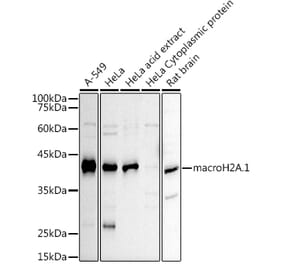 Western Blot - Anti-mH2A1 Antibody (A306291) - Antibodies.com