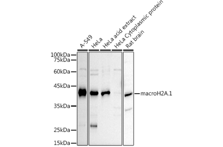 Western Blot - Anti-mH2A1 Antibody (A306291) - Antibodies.com