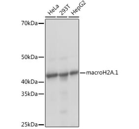 Western Blot - Anti-mH2A1 Antibody [ARC1396] (A306292) - Antibodies.com