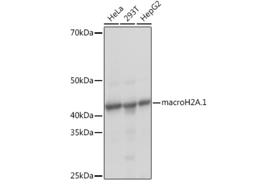 Western Blot - Anti-mH2A1 Antibody [ARC1396] (A306292) - Antibodies.com