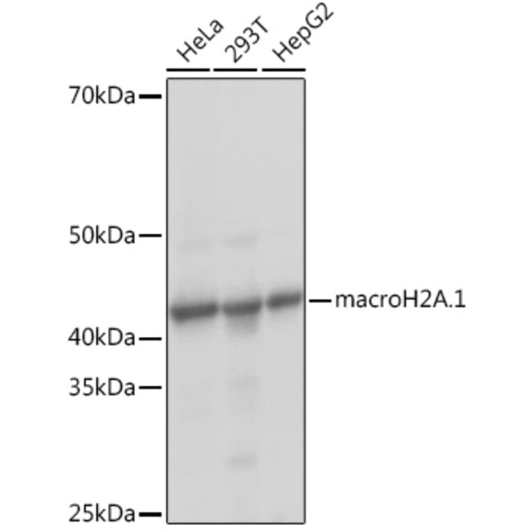 Western Blot - Anti-mH2A1 Antibody [ARC1396] (A306292) - Antibodies.com