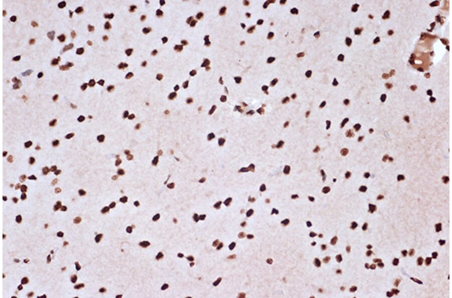 Immunohistochemistry - Anti-mH2A1 Antibody [ARC1396] (A306292) - Antibodies.com