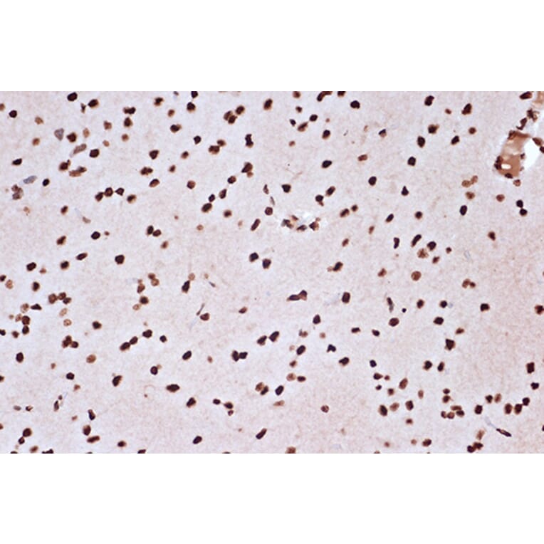 Immunohistochemistry - Anti-mH2A1 Antibody [ARC1396] (A306292) - Antibodies.com