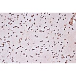 Immunohistochemistry - Anti-mH2A1 Antibody [ARC1396] (A306292) - Antibodies.com