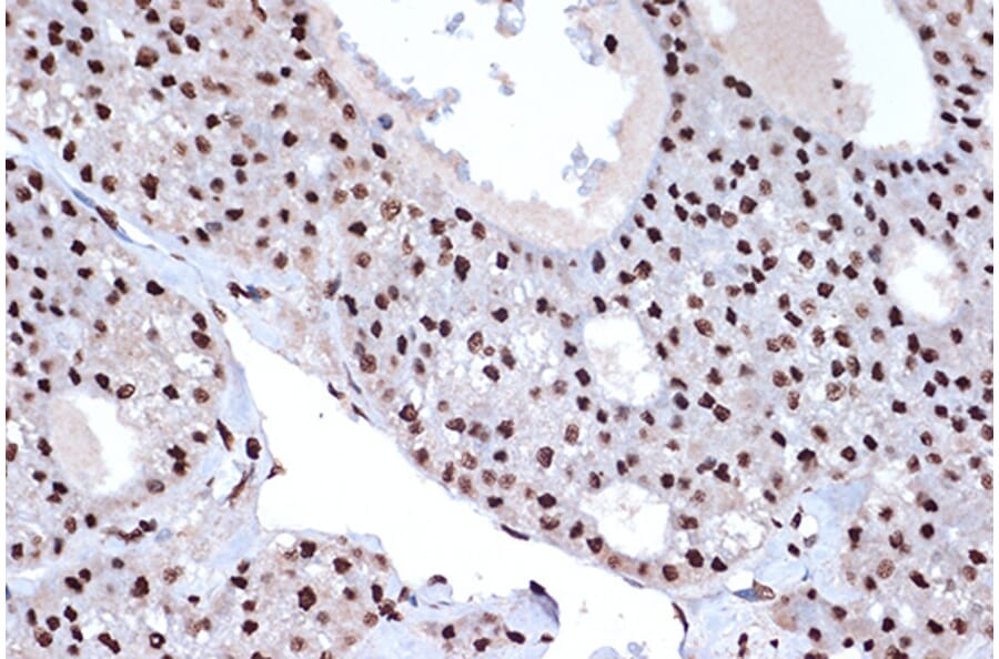 Immunohistochemistry - Anti-mH2A1 Antibody [ARC1396] (A306292) - Antibodies.com
