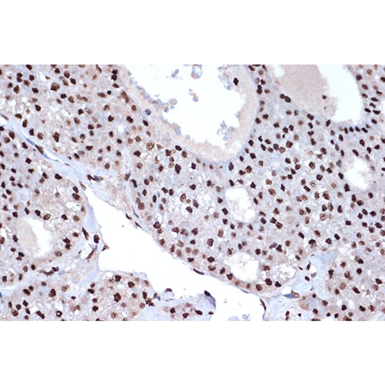 Immunohistochemistry - Anti-mH2A1 Antibody [ARC1396] (A306292) - Antibodies.com