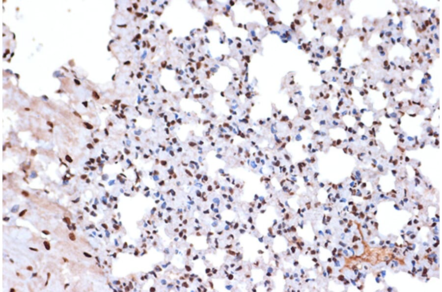 Immunohistochemistry - Anti-mH2A1 Antibody [ARC1396] (A306292) - Antibodies.com