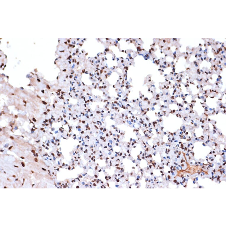 Immunohistochemistry - Anti-mH2A1 Antibody [ARC1396] (A306292) - Antibodies.com