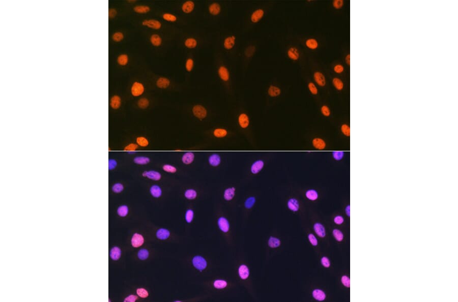 Immunofluorescence - Anti-mH2A1 Antibody [ARC1396] (A306292) - Antibodies.com