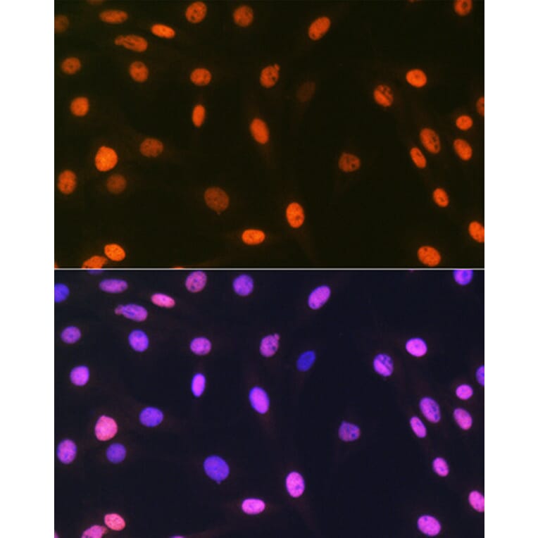 Immunofluorescence - Anti-mH2A1 Antibody [ARC1396] (A306292) - Antibodies.com