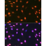 Immunofluorescence - Anti-mH2A1 Antibody [ARC1396] (A306292) - Antibodies.com